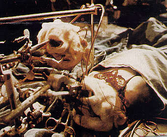 white rhesus monkey full head transplant by Dr. Robert White circa 1970