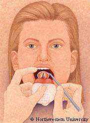colored drawing of a doctor examining a patient's throat with a mirror.