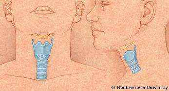 colored drawing featuring the front and side view of a human larynx.